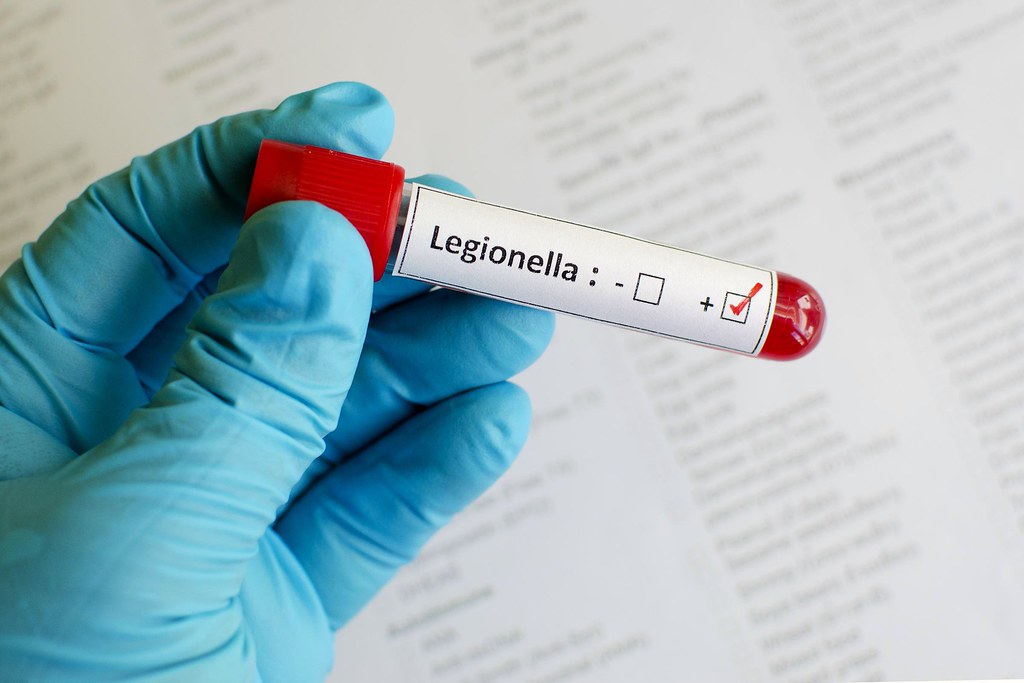 Czym jest Bakteria Legionella i jakie powoduje choroby